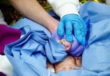 Bebé encontrado em caixote do lixo já está com uma família de acolhimento