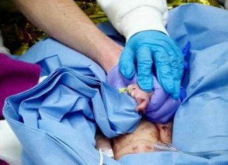 Bebé encontrado em caixote do lixo já está com uma família de acolhimento