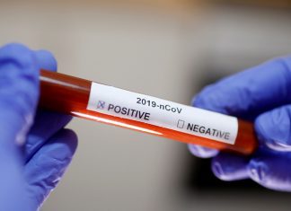Autoridade de Saúde Regional – São Miguel continua a registar casos positivos