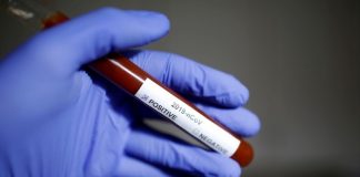 Autoridade de Saúde- Detetados três casos positivos em São Miguel