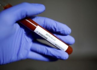 Autoridade de Saúde- Detetados três casos positivos em São Miguel