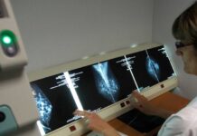 Governo dos Açores avança com alterações de posicionamento remuneratório dos Técnicos Superiores de Diagnóstico e Terapêutica DR