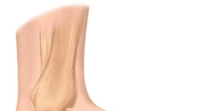 Click Saúde & Bem Estar – O que é a fascite plantar? Como se identifica? Quais as soluções?