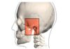 A Fisioterapia e a Osteopatia na ATM Articulação Temporomandibular (articulação da boca) DR