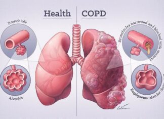 Fisioterapia Respiratória