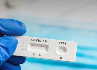Testagem massiva deteta 53 casos positivos