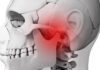 Fisioterapia eficaz no Bruxismo