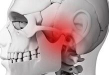 Fisioterapia eficaz no Bruxismo