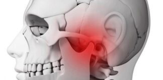 Fisioterapia eficaz no Bruxismo