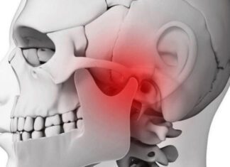 Fisioterapia eficaz no Bruxismo