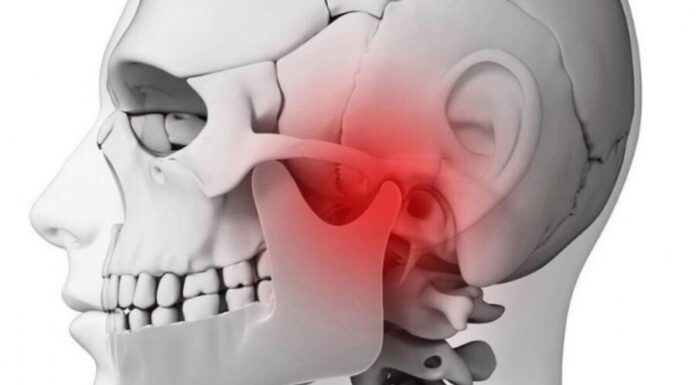 Fisioterapia eficaz no Bruxismo