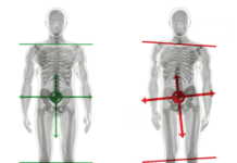 Click Saúde & Bem Estar | Fisioterapia na Síndrome da Deficiência Postural na Gravidez
