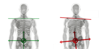 Click Saúde & Bem Estar | Fisioterapia na Síndrome da Deficiência Postural na Gravidez