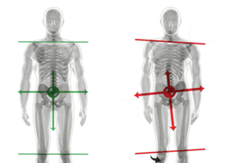 Click Saúde & Bem Estar | Fisioterapia na Síndrome da Deficiência Postural na Gravidez