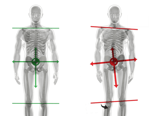 Click Saúde & Bem Estar | Fisioterapia na Síndrome da Deficiência Postural na Gravidez