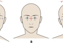 Click Saúde & Bem Estar | Fisioterapia, o Olho e a Postura! Qual a relação?