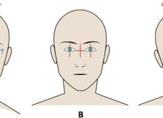 Click Saúde & Bem Estar | Fisioterapia, o Olho e a Postura! Qual a relação?